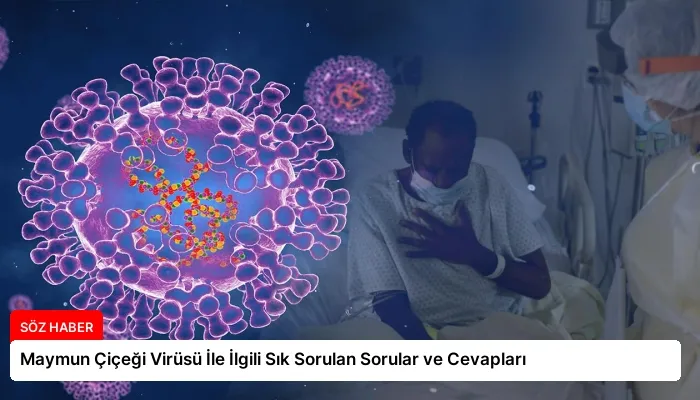 Maymun Çiçeği Virüsü İle İlgili Sık Sorulan Sorular ve Cevapları