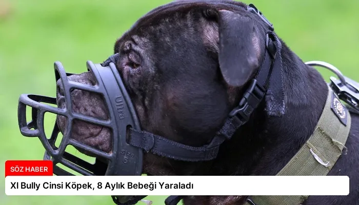 Xl Bully Cinsi Köpek, 8 Aylık Bebeği Yaraladı