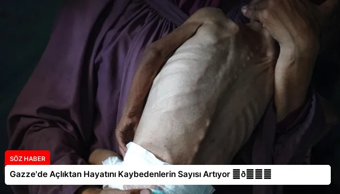 Gazze’de Açlıktan Hayatını Kaybedenlerin Sayısı Artıyor ⏬👇