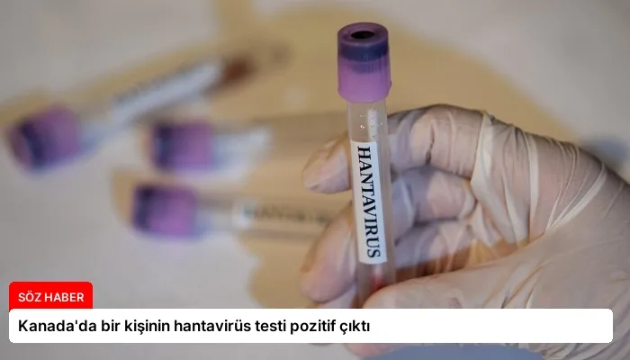 Kanada’da bir kişinin hantavirüs testi pozitif çıktı