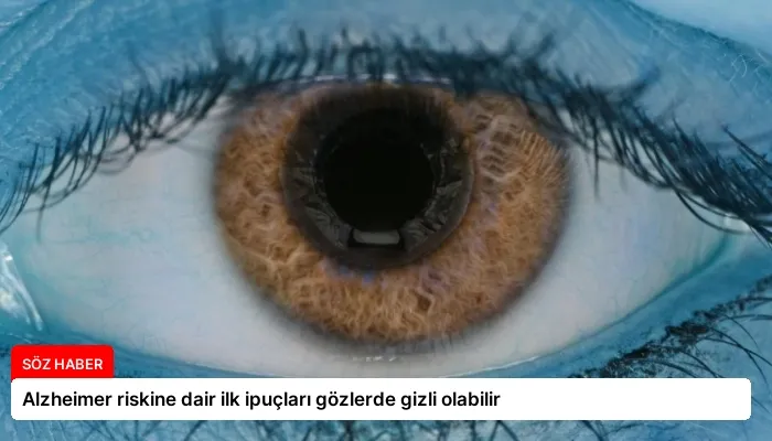 Alzheimer riskine dair ilk ipuçları gözlerde gizli olabilir