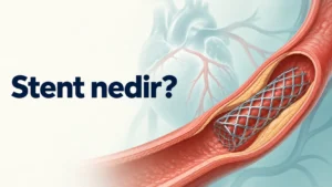 Stent nedir?