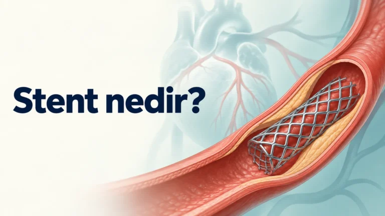 Stent nedir?